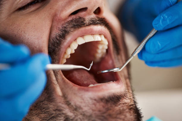 Best Emergency Dental Care for Sports Injuries in Whitemarsh Island, GA