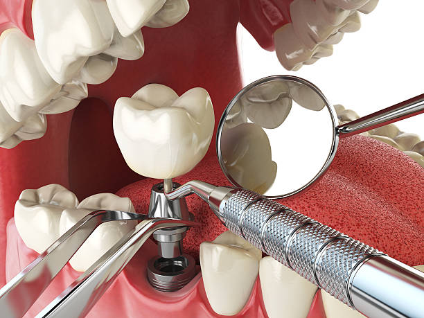 Best Emergency Denture Repair in Whitemarsh Island, GA